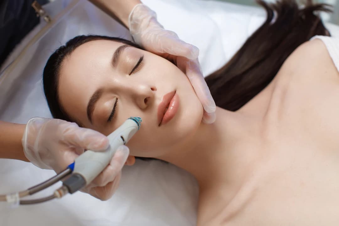 Hydroderma Facial Treatment - Image 7
