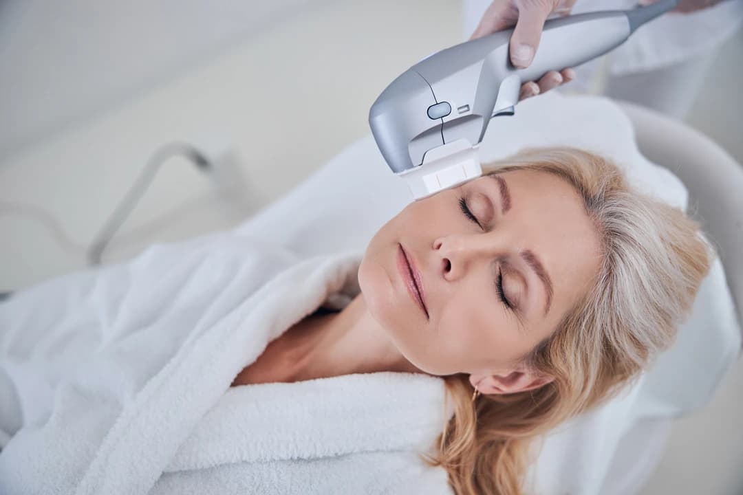 IPL Photofacial - Image 1