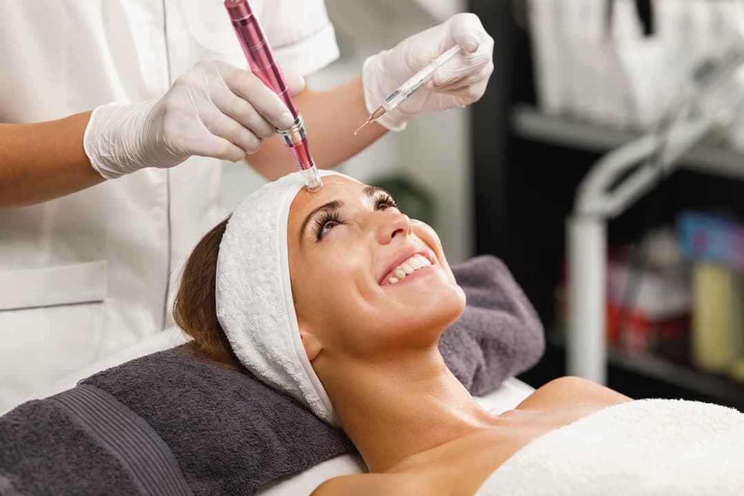 Microneedling - Image 4